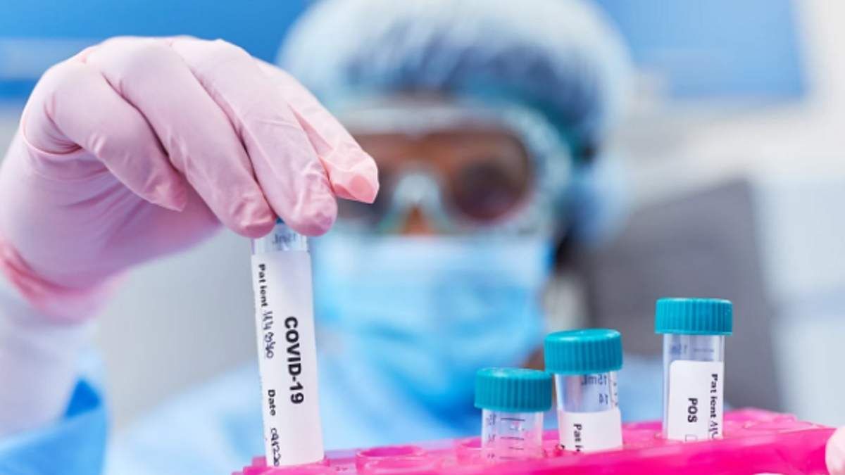 Щодоби 55 тисяч випадків COVID-19: тривожний прогноз від КSE - Україна новини - 24 Канал Щодоби 55 тисяч випадків COVID-19: тривожний прогноз від КSE - Україна новини - 24 Канал