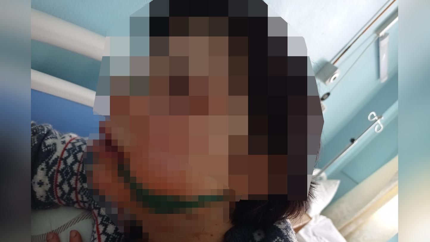 Киевлянин изуродовал лицо женщины холодным оружием: пострадавшая находится в больнице
