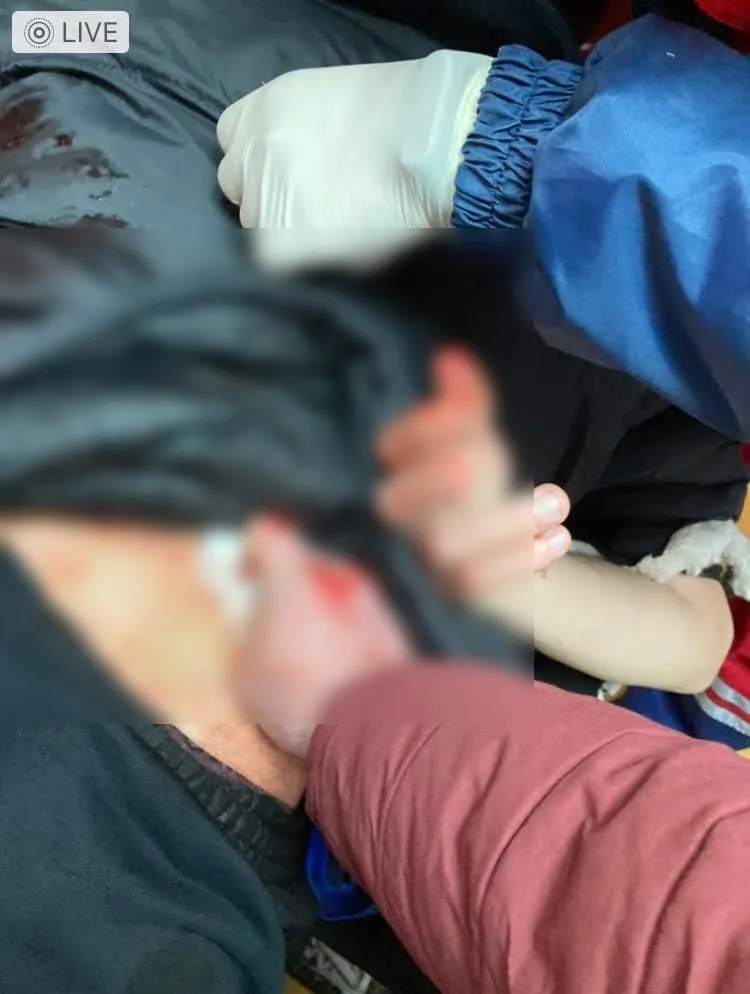 Був весь у крові: на Львівщині медики 3 лікарень відмовилися допомогти важкопораненому чоловіку Був весь у крові: на Львівщині медики 3 лікарень відмовилися допомогти важкопораненому чоловіку