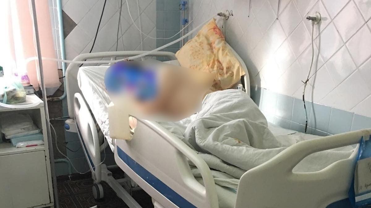 Ушел из дома в морозы: в Одесской области 16-летнему парню ампутировали обе ноги Ушел из дома в морозы: в Одесской области 16-летнему парню ампутировали обе ноги