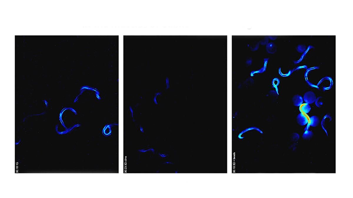 Дослідження нематод допоможе боротися з наслідками мікрогравітації - Новини технологій - Техно Дослідження нематод допоможе боротися з наслідками мікрогравітації - Новини технологій - Техно
