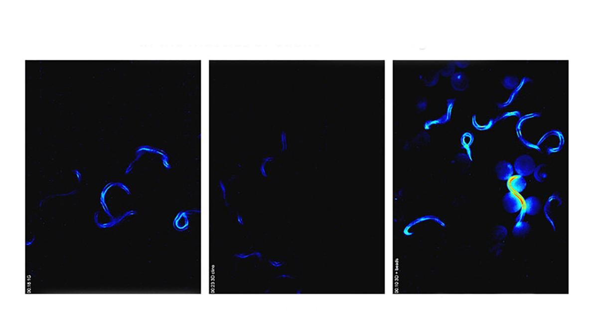 Дослідження нематод допоможе боротися з наслідками мікрогравітації - Новини технологій - Техно
