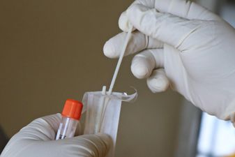 В Україні поступово знижується захворюваність на COVID-19: остання статистика