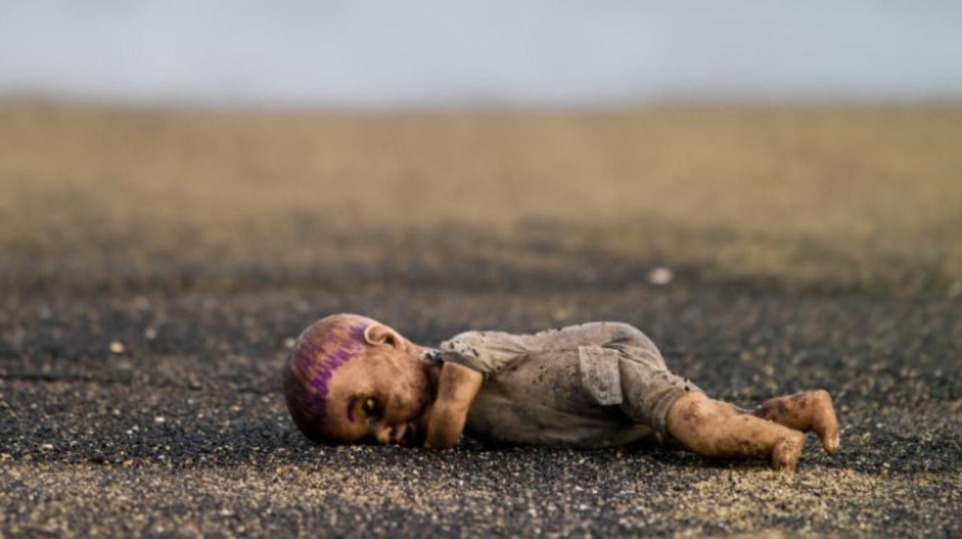 После обстрела детсада в Ахтырке ранены 8 человек, среди них есть дети - 24 Канал После обстрела детсада в Ахтырке ранены 8 человек, среди них есть дети - 24 Канал