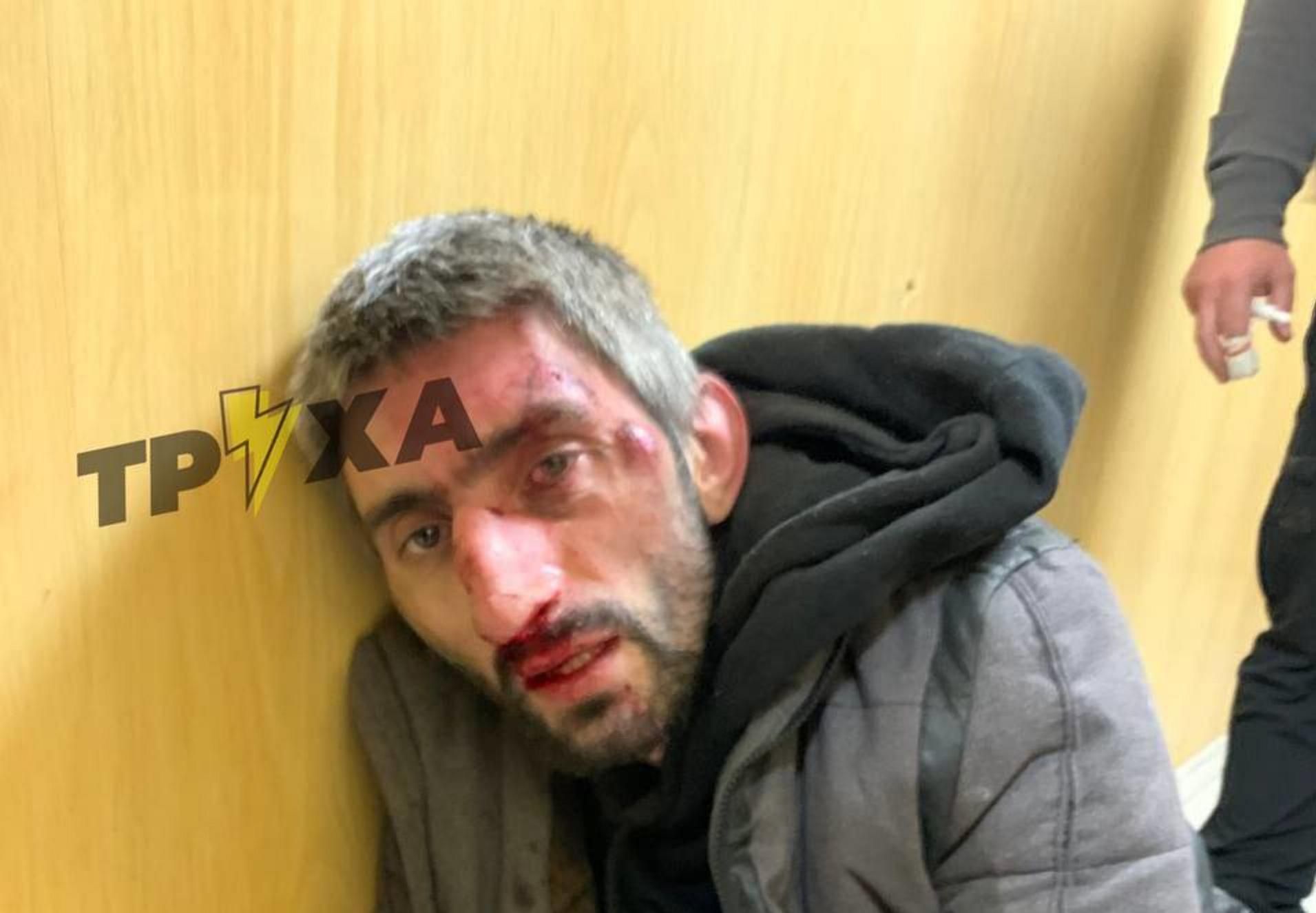 Топаза спіймали на мародерстві – судимий антимайданівець знову "відзначився" - 24 Канал Топаза спіймали на мародерстві – судимий антимайданівець знову "відзначився" - 24 Канал