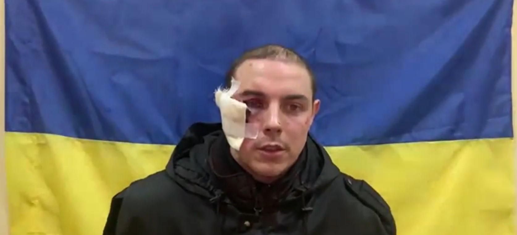 Він не навчаннях: ЗСУ показали російських віськових, які здалися в полон - 24 Канал Він не навчаннях: ЗСУ показали російських віськових, які здалися в полон - 24 Канал