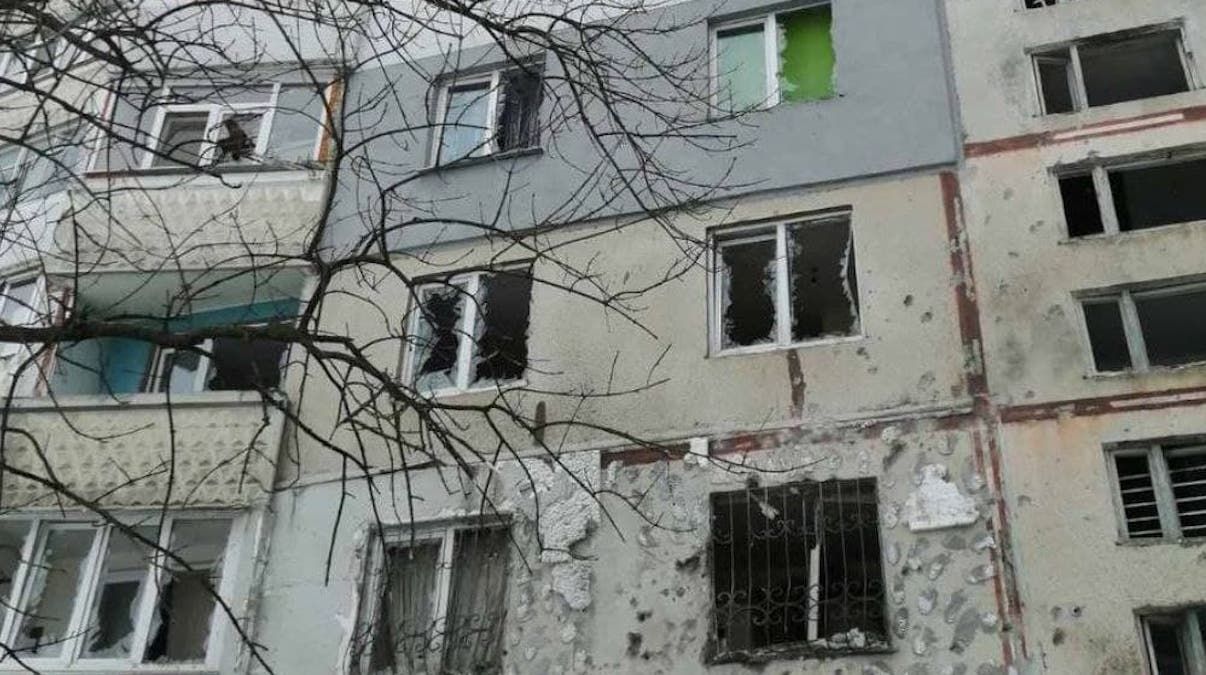 Хірург із Харкова показав знімок 10 річного хлопчика – в його будинок влучив снаряд - 24 Канал Хірург із Харкова показав знімок 10 річного хлопчика – в його будинок влучив снаряд - 24 Канал