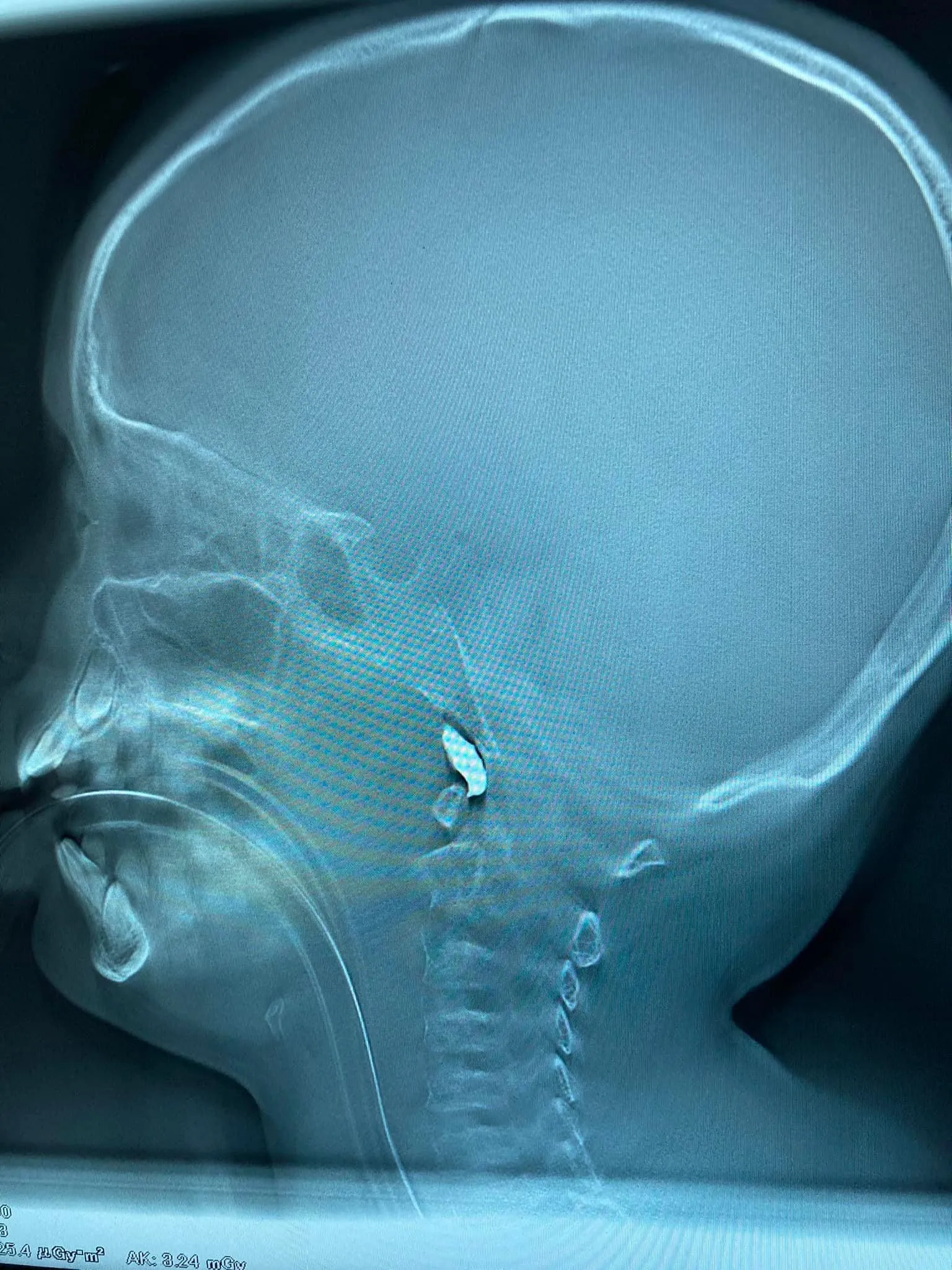 Харьков Харьков