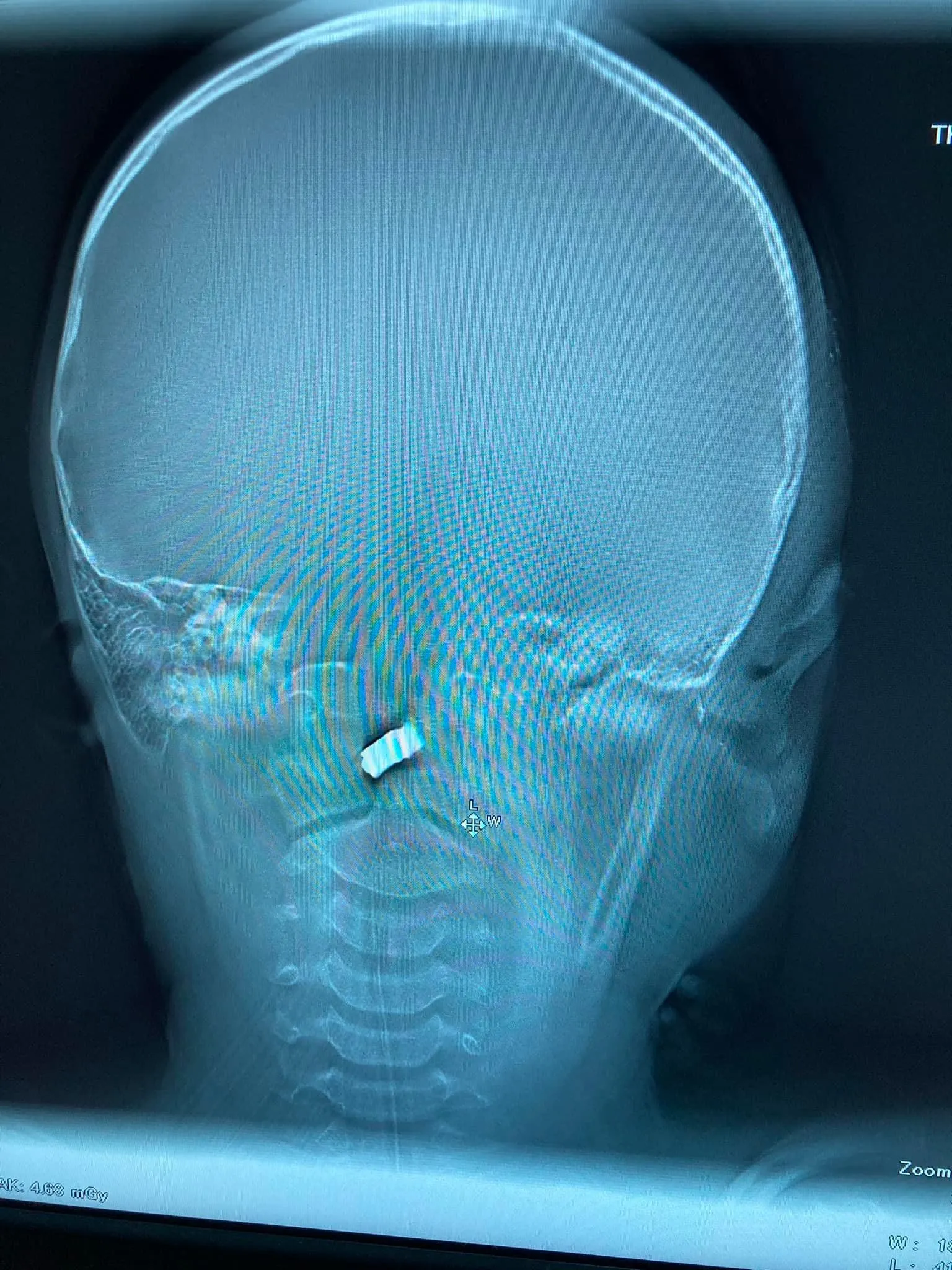 Харьков Харьков