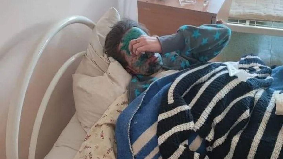 Так виглядає "рускій мір": у Сєвєродонецьку постраждала жінка і двоє її дітей-близнюків - 24 Канал Так виглядає "рускій мір": у Сєвєродонецьку постраждала жінка і двоє її дітей-близнюків - 24 Канал