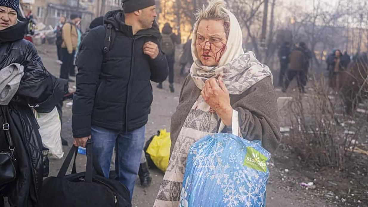 28 днів війни: в ОП кажуть, що Росія вже не воює проти ЗСУ, а лише проти мирних громадян - 24 Канал