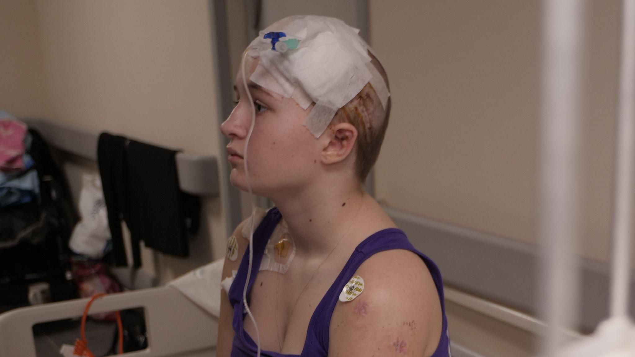 В Киеве прооперировали 13-летнюю девочку, в черепе которой застрял осколок после обстрела В Киеве прооперировали 13-летнюю девочку, в черепе которой застрял осколок после обстрела