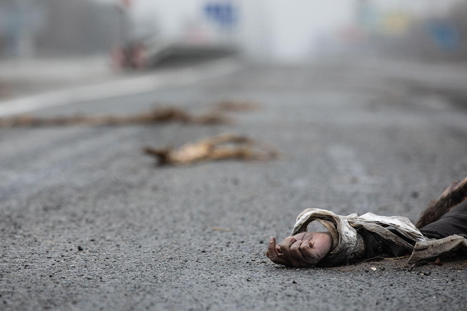 До сьогодні ми не можемо порахувати всіх жертв окупантів на Сумщині, – Живицький - 24 Канал