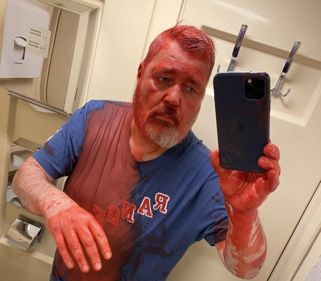 У російському потязі невідомий напав на головного редактора опозиційної "Нової газети" - 24 Канал У російському потязі невідомий напав на головного редактора опозиційної "Нової газети" - 24 Канал