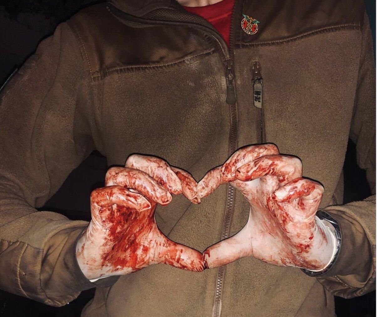 Фото медика "Азова" с окровавленными перчатками покорило сеть