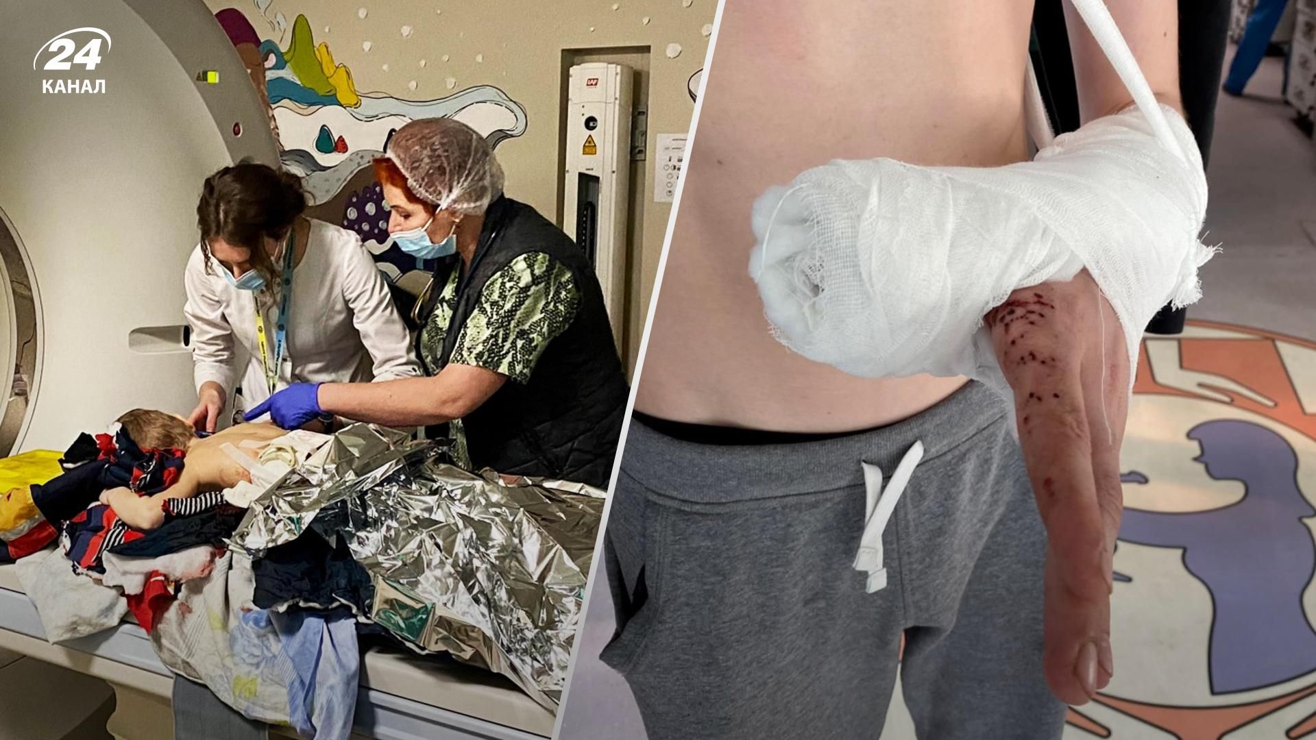 Скільки дітей постраждали внаслідок війни Росії в Україні: оновлені дані Скільки дітей постраждали внаслідок війни Росії в Україні: оновлені дані