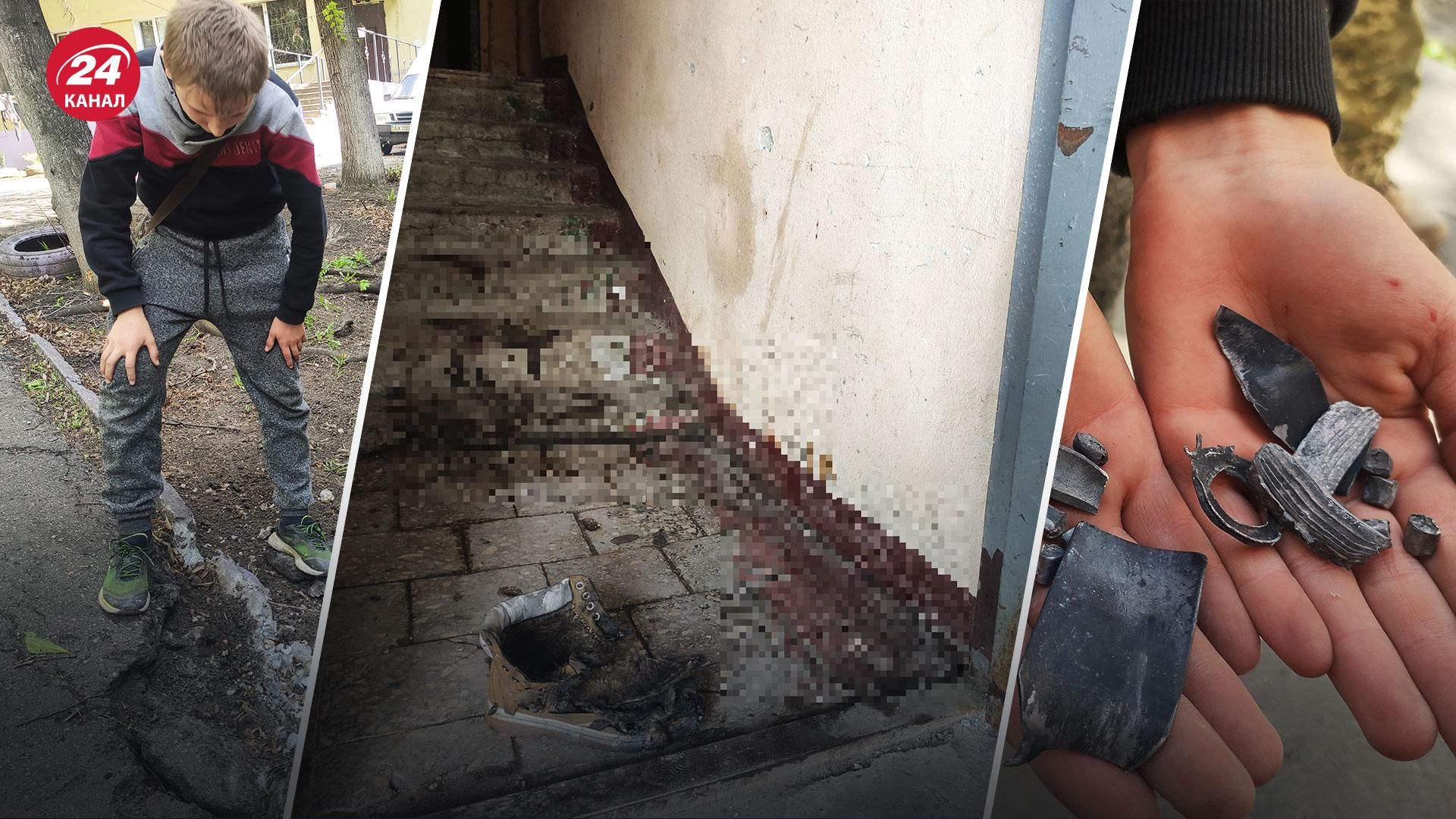 Загинули 3 людей, жінці відірвало ноги: жахливі фото та відео наслідків обстрілу Харкова - 24 Канал