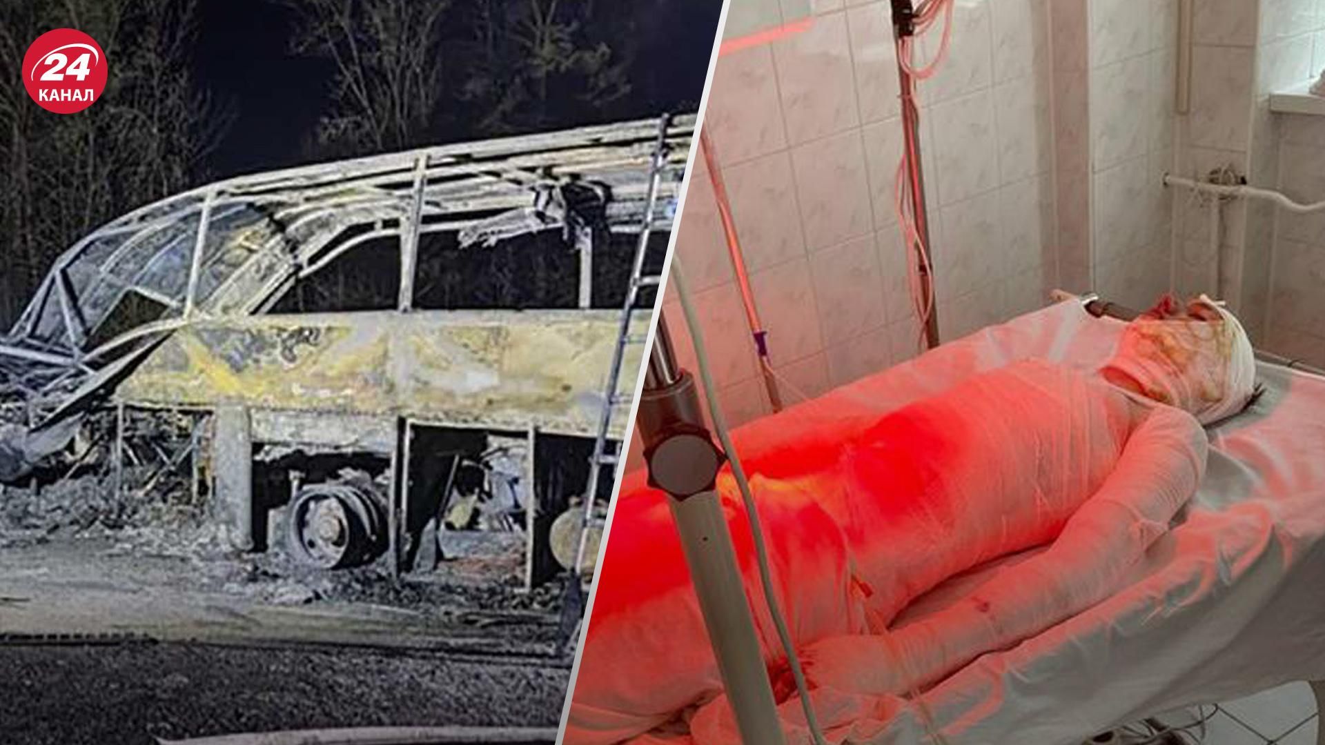 Пытался спасти маму: 17-летний парень в ужасном ДТП в Ровненской области получил 60% ожогов тела Пытался спасти маму: 17-летний парень в ужасном ДТП в Ровненской области получил 60% ожогов тела