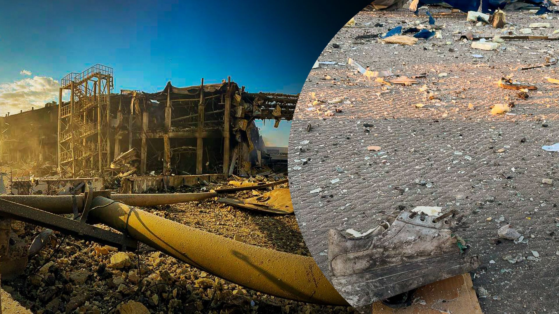 У лікарнях Одеси перебувають 2 людей, поранених внаслідок ракетного удару: який їхній стан У лікарнях Одеси перебувають 2 людей, поранених внаслідок ракетного удару: який їхній стан