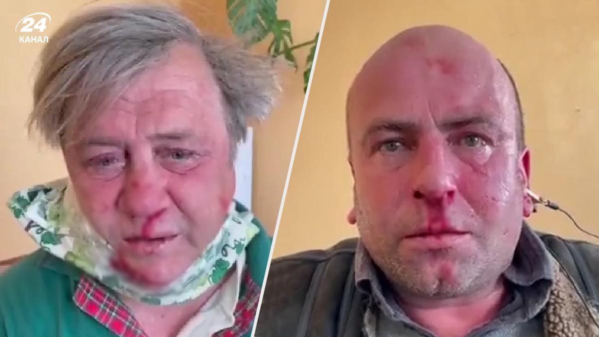 Окупанти катують людей на Херсонщині та викладають відео в соцмережі 18+ Окупанти катують людей на Херсонщині та викладають відео в соцмережі 18+