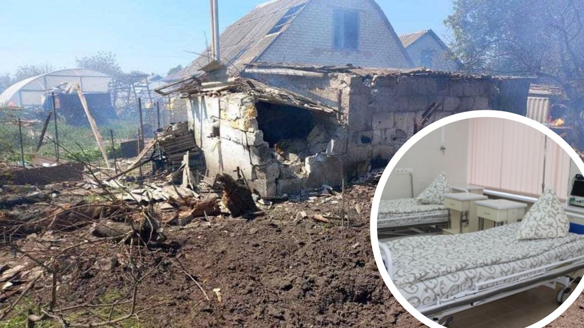 На Миколаївщині від російських обстрілів постраждали 13 людей На Миколаївщині від російських обстрілів постраждали 13 людей