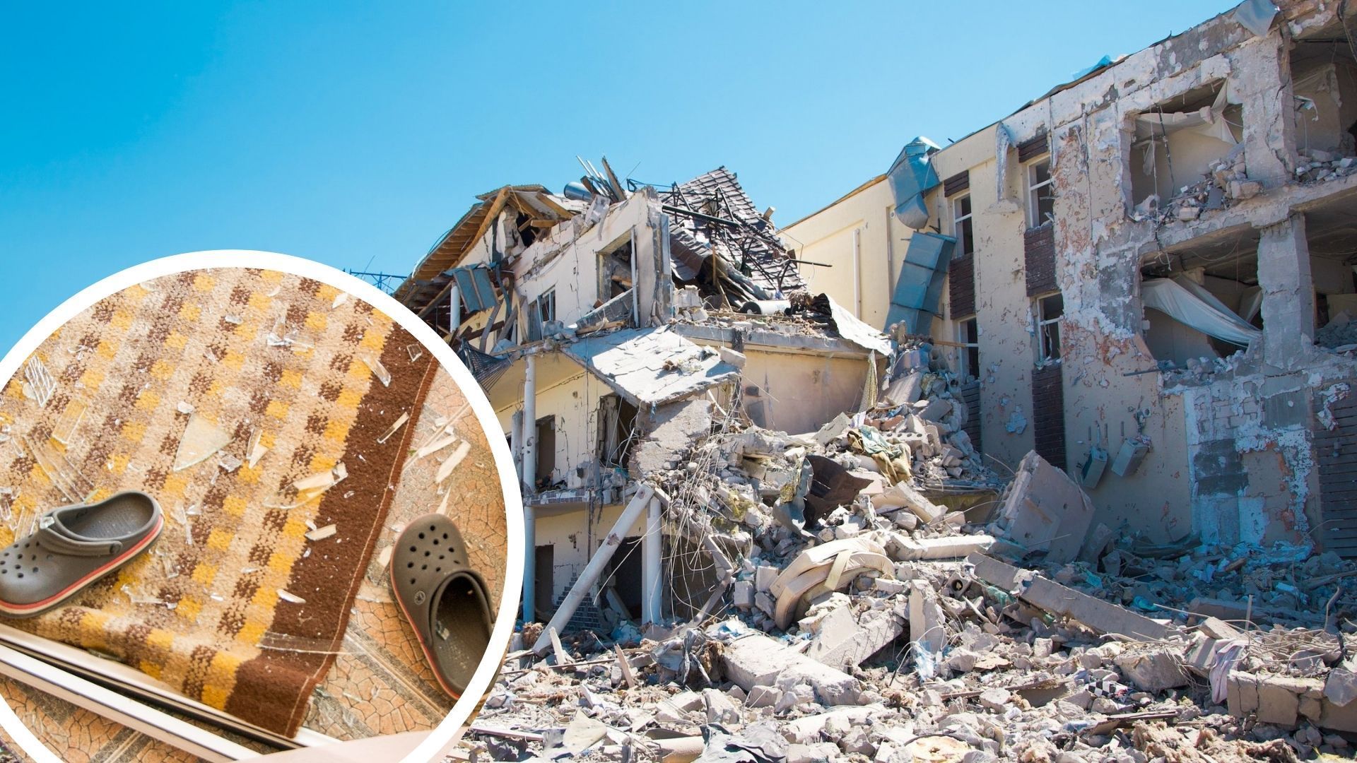 Дівчинку, яка постраждала від ракетного удару по базі відпочинку на Одещині, прооперували Дівчинку, яка постраждала від ракетного удару по базі відпочинку на Одещині, прооперували