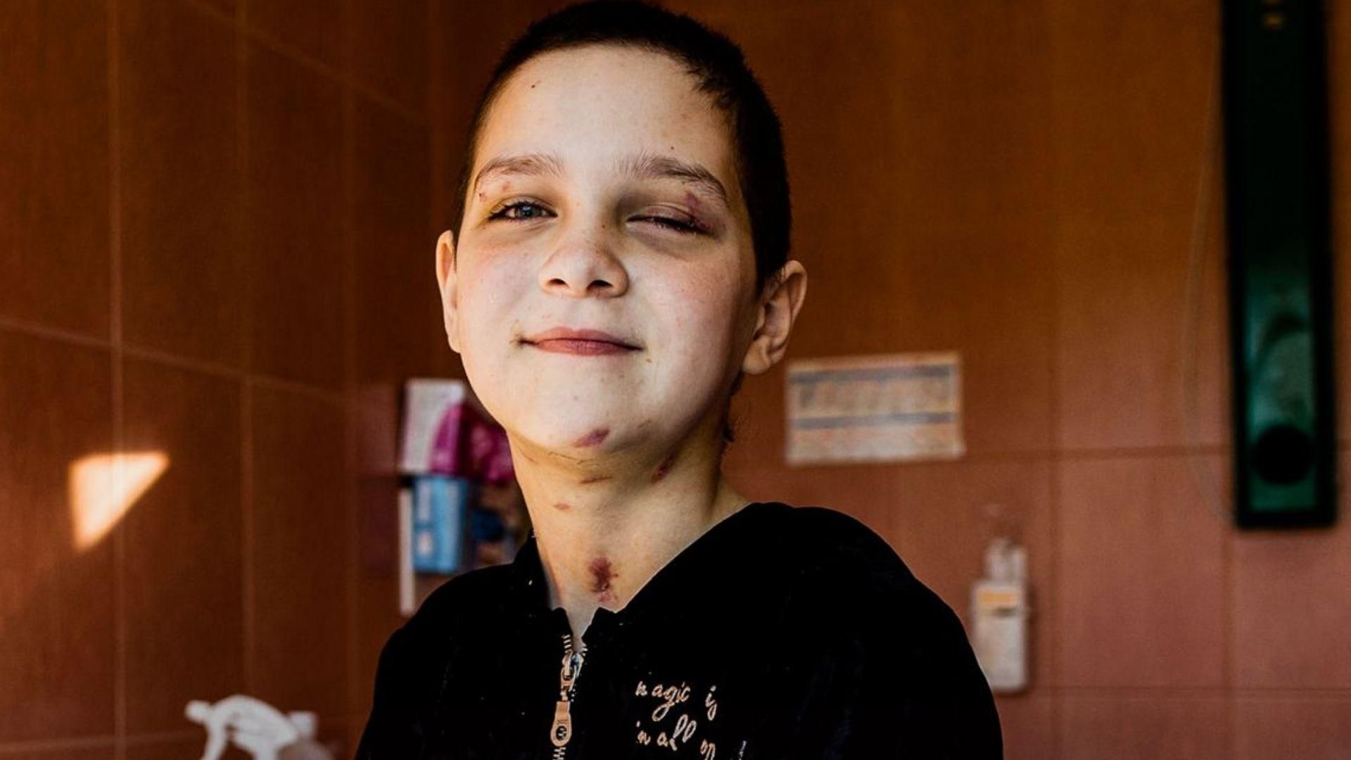 Дом обстреляли из танка, выжила только она: Садовый рассказал историю маленькой Вероники Дом обстреляли из танка, выжила только она: Садовый рассказал историю маленькой Вероники