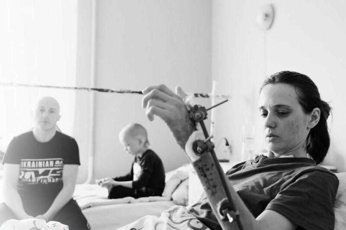Російська ракета забрала в неї руку, ногу та дитину: історія Катерини з Лимана Російська ракета забрала в неї руку, ногу та дитину: історія Катерини з Лимана