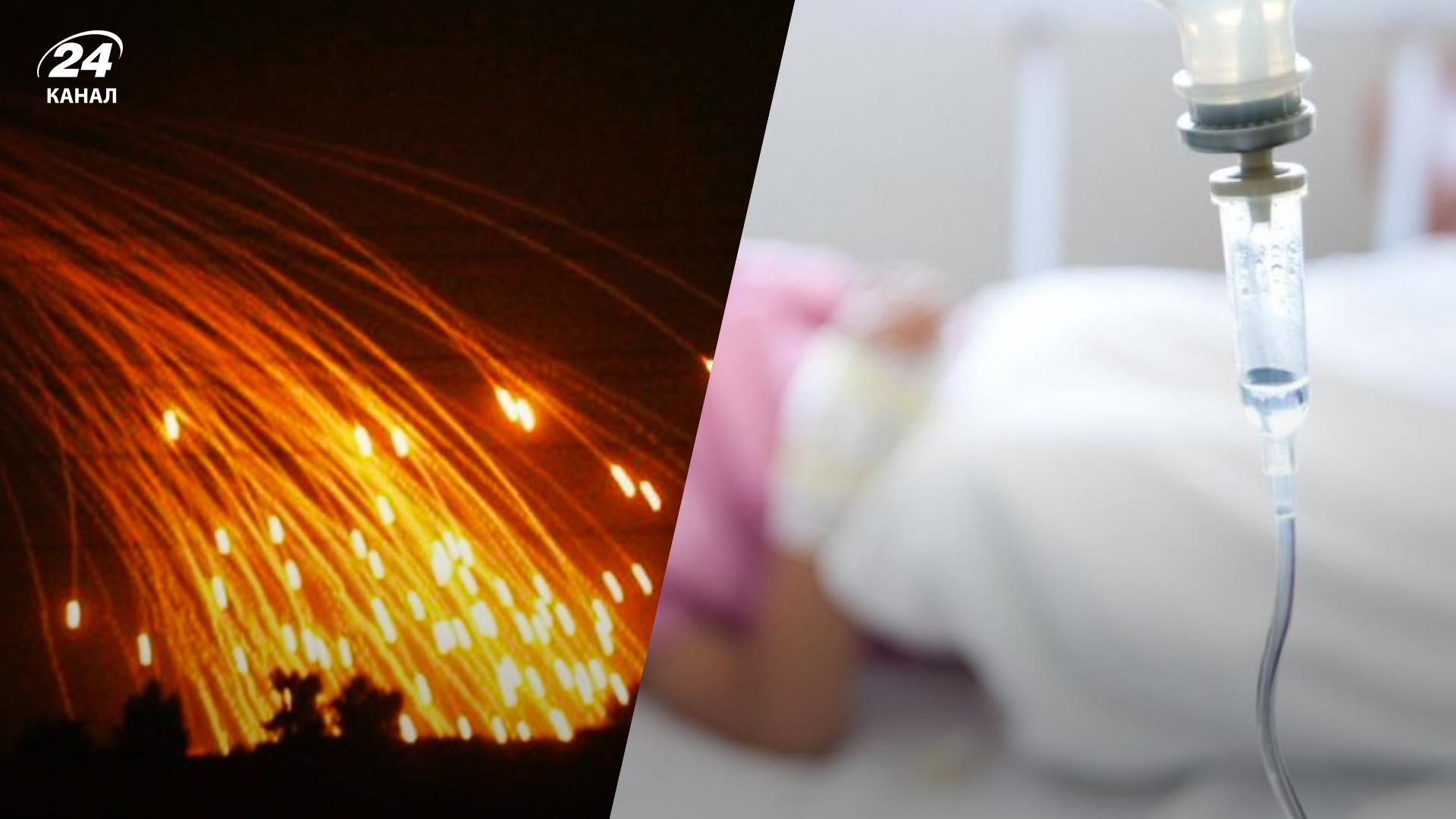В Сумской области использовали запрещенные фосфорные снаряды: в больнице ребенок