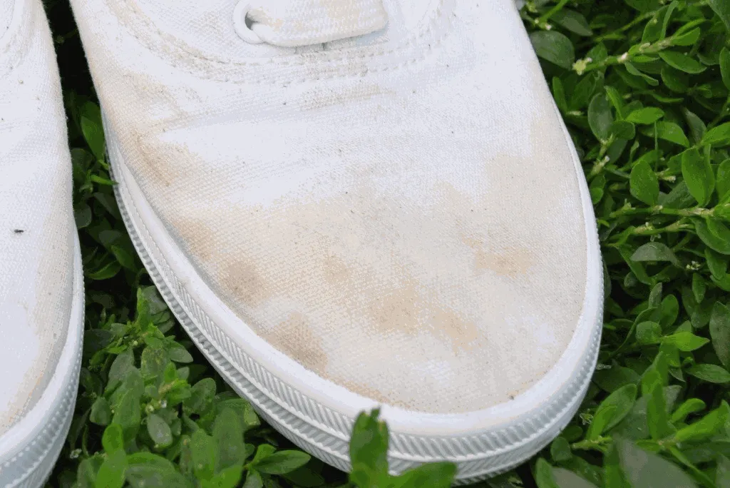 Пожелтение на обуви Пожелтение на обуви