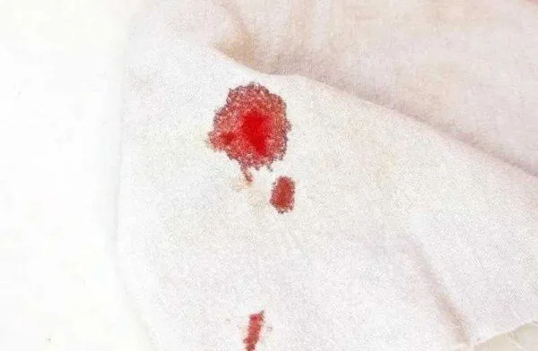 Пятна крови Пятна крови