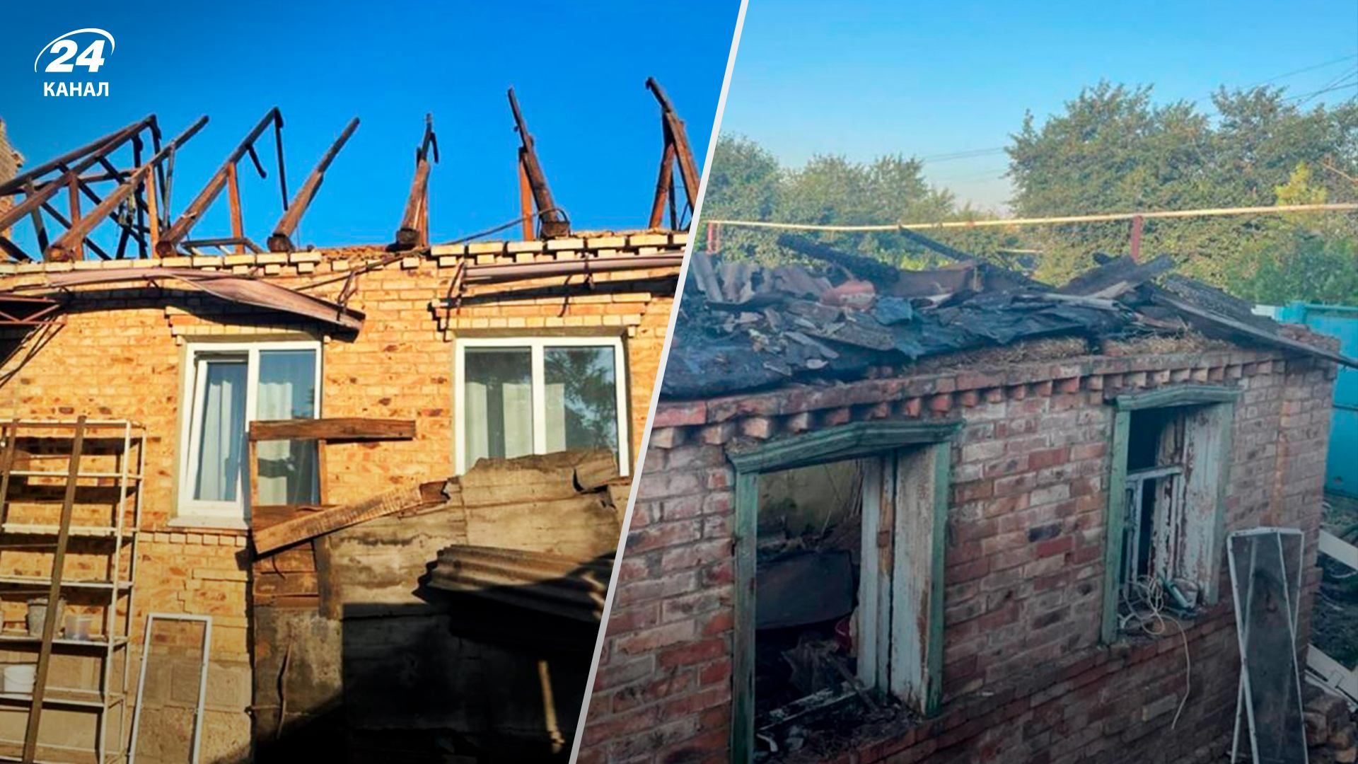 Обстріли Бахмута та Сіверська - у важкому стані 12-річний хлопчик Обстріли Бахмута та Сіверська - у важкому стані 12-річний хлопчик