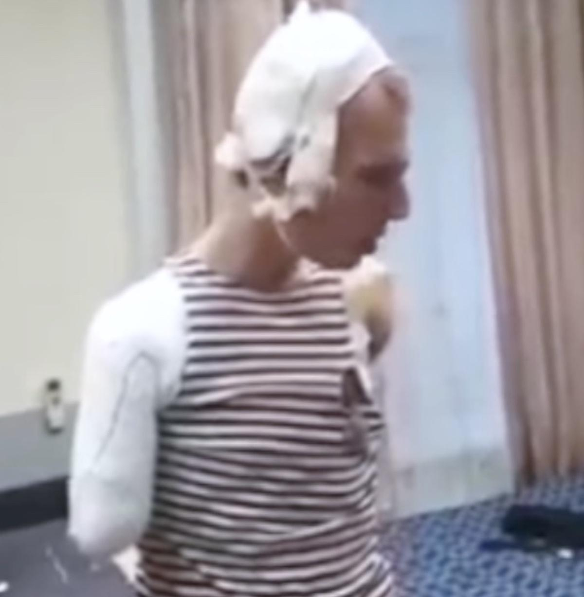 Вместо побед российские оккупанты привозят с войны в Украине инвалидность