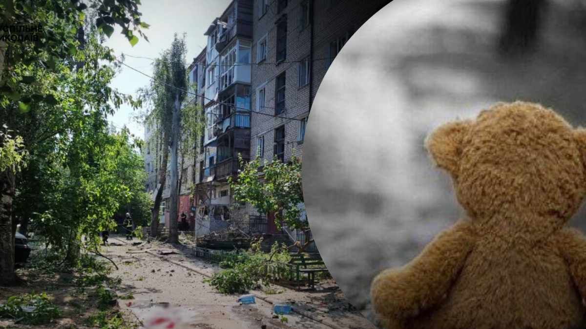 Николаев обстреляли 10 августа – раненый ребенок Николаев обстреляли 10 августа – раненый ребенок