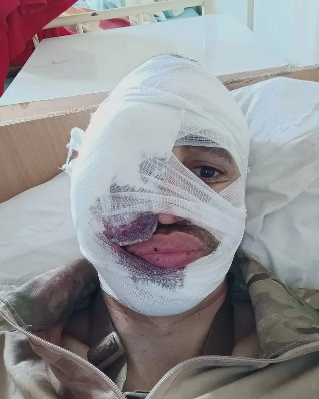 Віктор Стороженко отримав поранення на війні Віктор Стороженко отримав поранення на війні