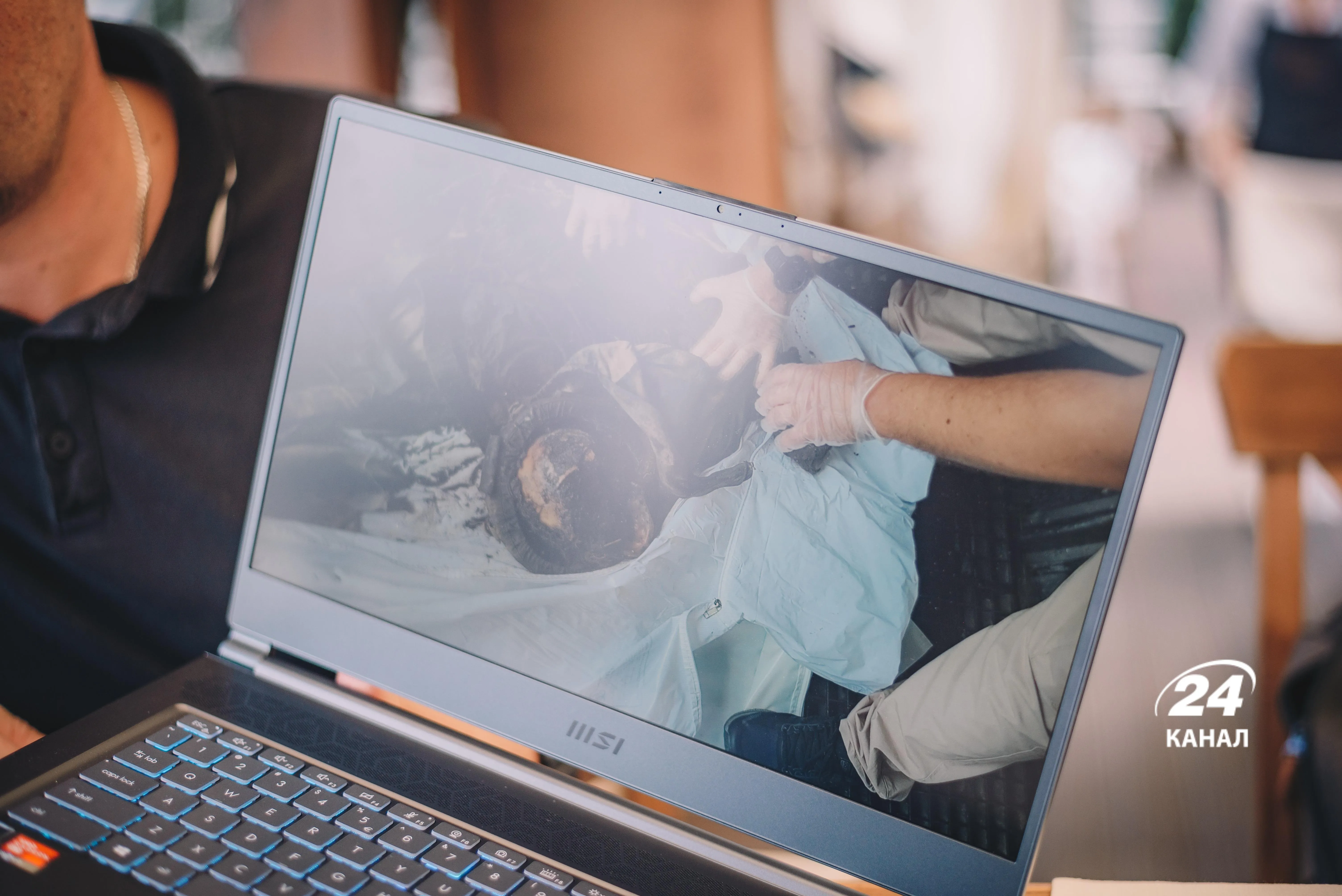 Вбитий кадирівець Вбитий кадирівець