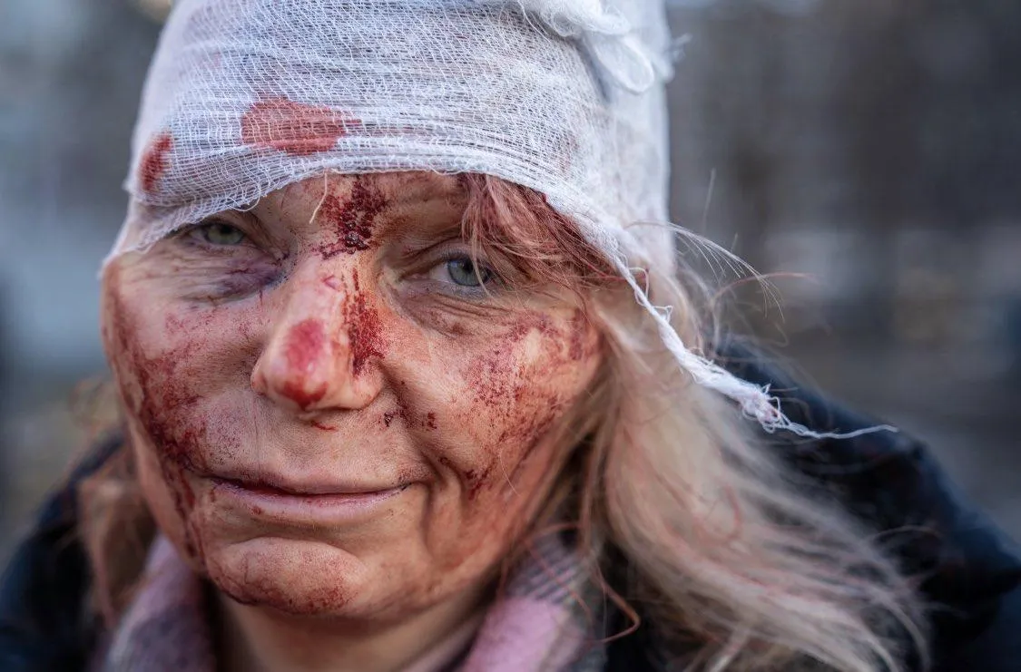 Жительница Чугуева на Харьковщине ранена после бомбежки в первое утро войны