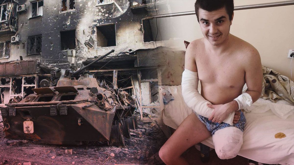 Владислав получил ранение в Мариуполе у собственного дома Владислав получил ранение в Мариуполе у собственного дома