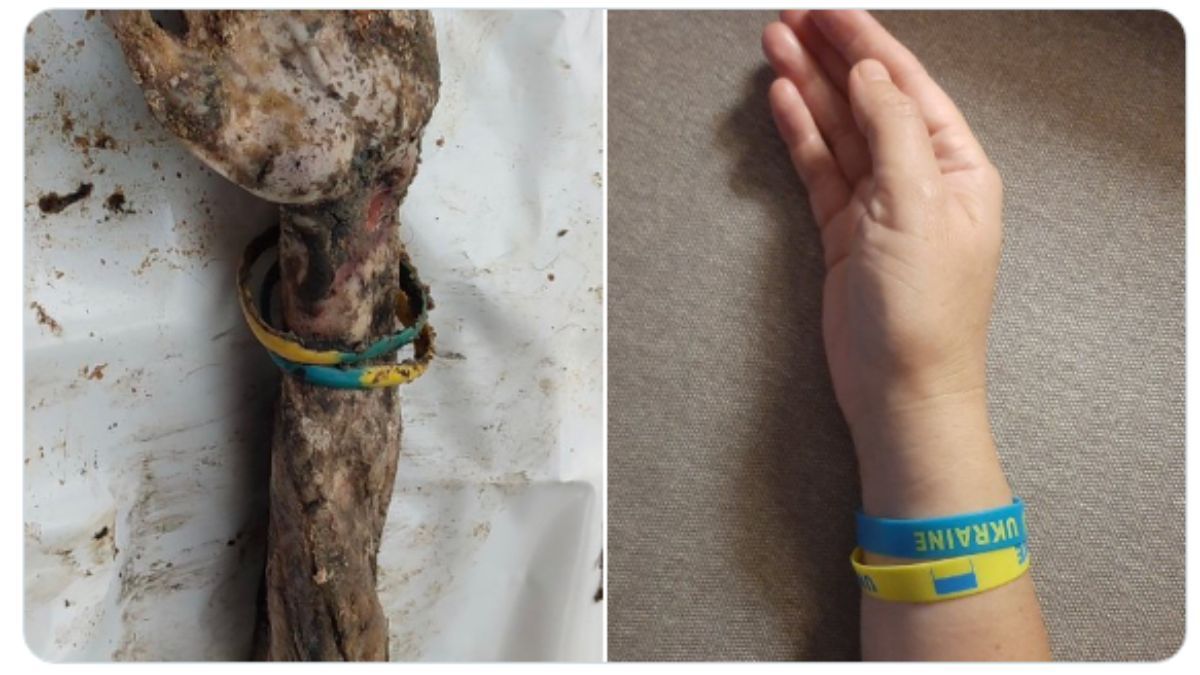 Українці поширюють фото руки з браслетом з Ізюма - флешмоб