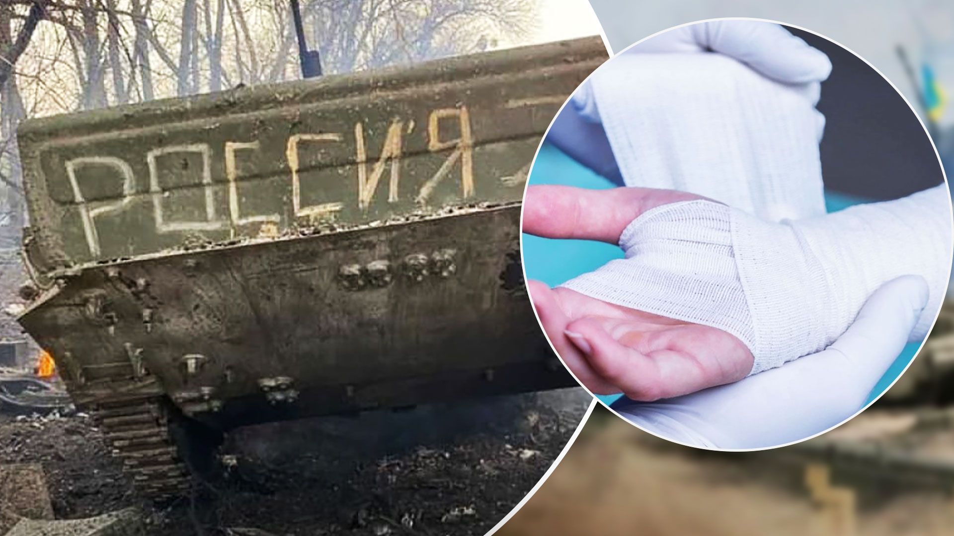 У росії виник дефіцит перев'язувальних і кровоспинних засобів - 24 Канал У росії виник дефіцит перев'язувальних і кровоспинних засобів - 24 Канал