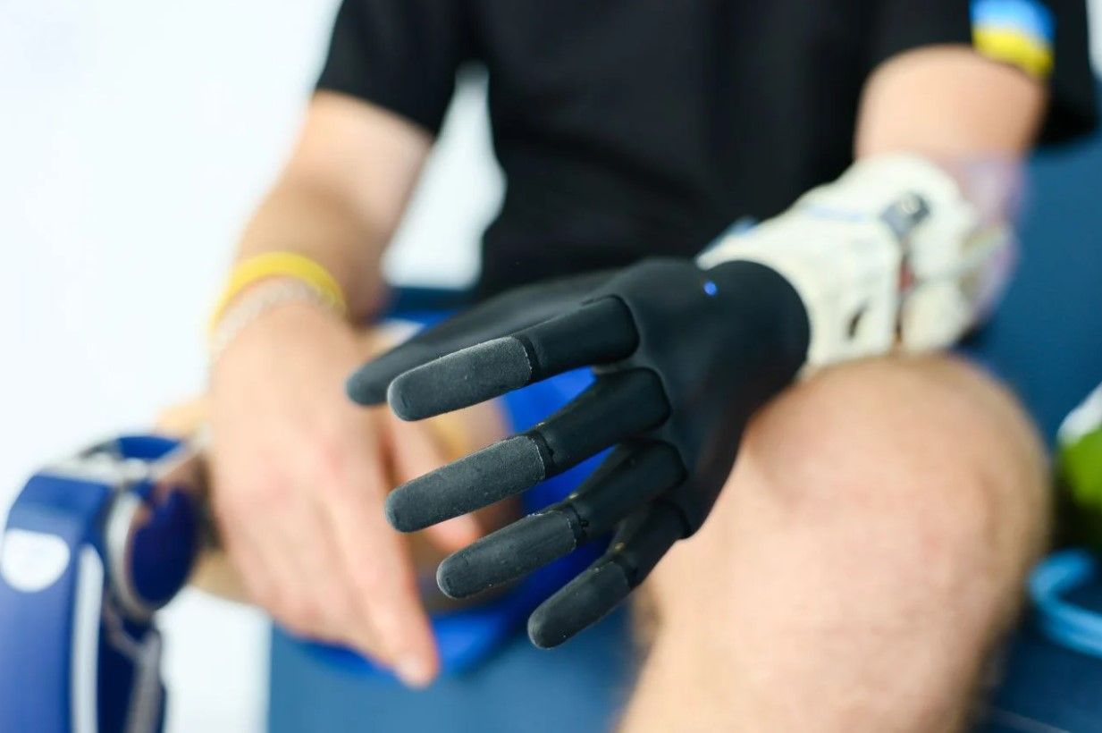 Акция Протезы для несгибаемых – как присоединиться и куда пойдут деньги Акция Протезы для несгибаемых – как присоединиться и куда пойдут деньги