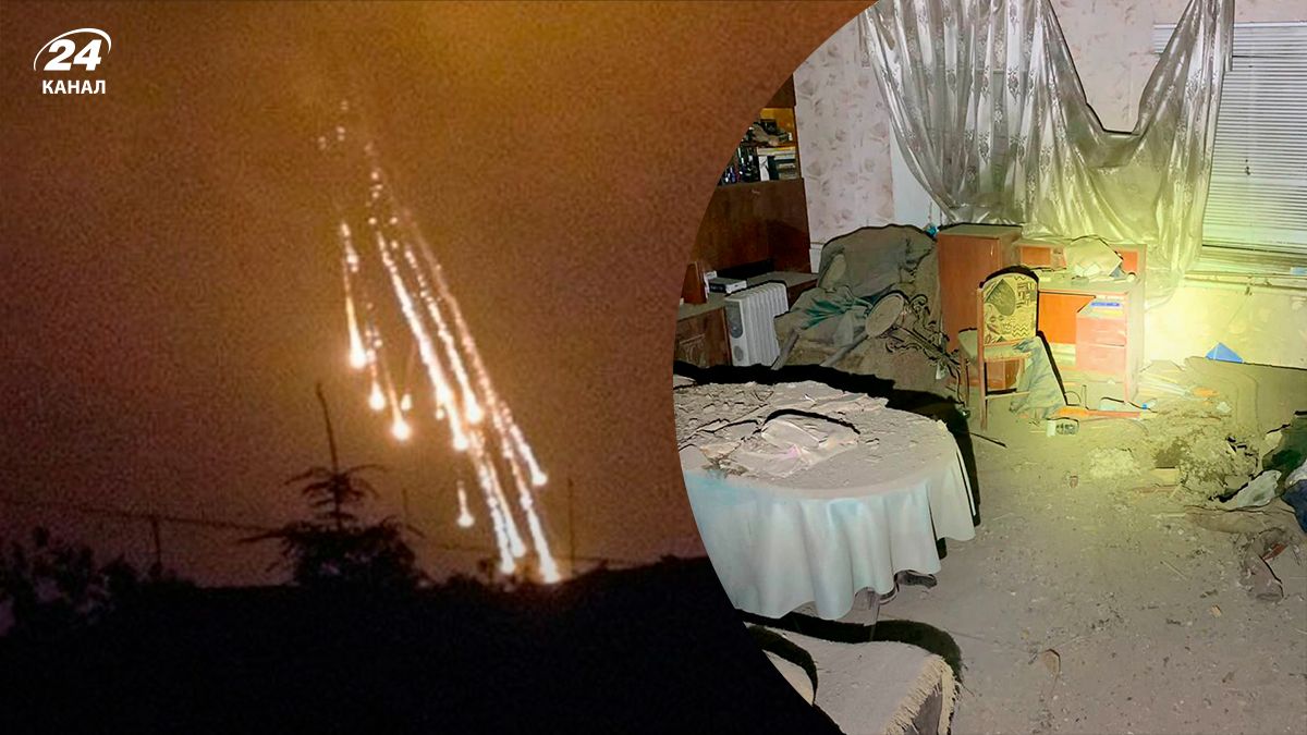 Из-за атаки россиян в Никополе 6-летний ребенок потерял ноги Из-за атаки россиян в Никополе 6-летний ребенок потерял ноги