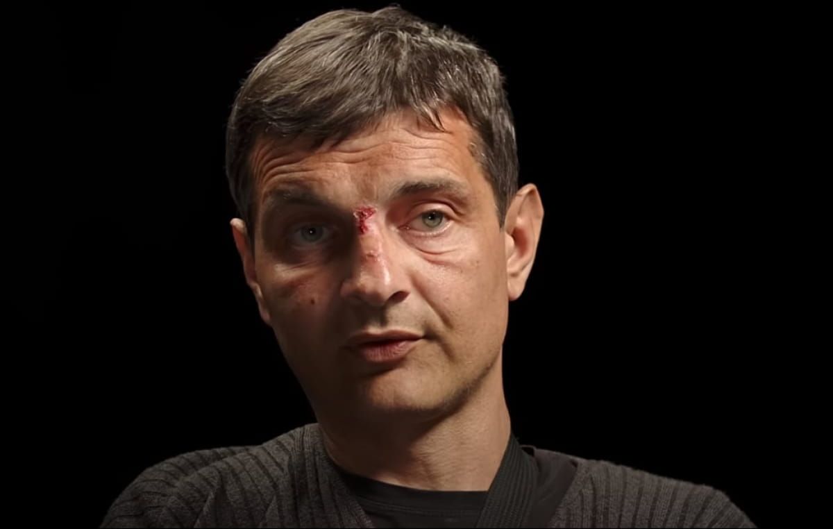 Михайло Діанов - захисник усі гроші віддає на лікування побратимів Михайло Діанов - захисник усі гроші віддає на лікування побратимів