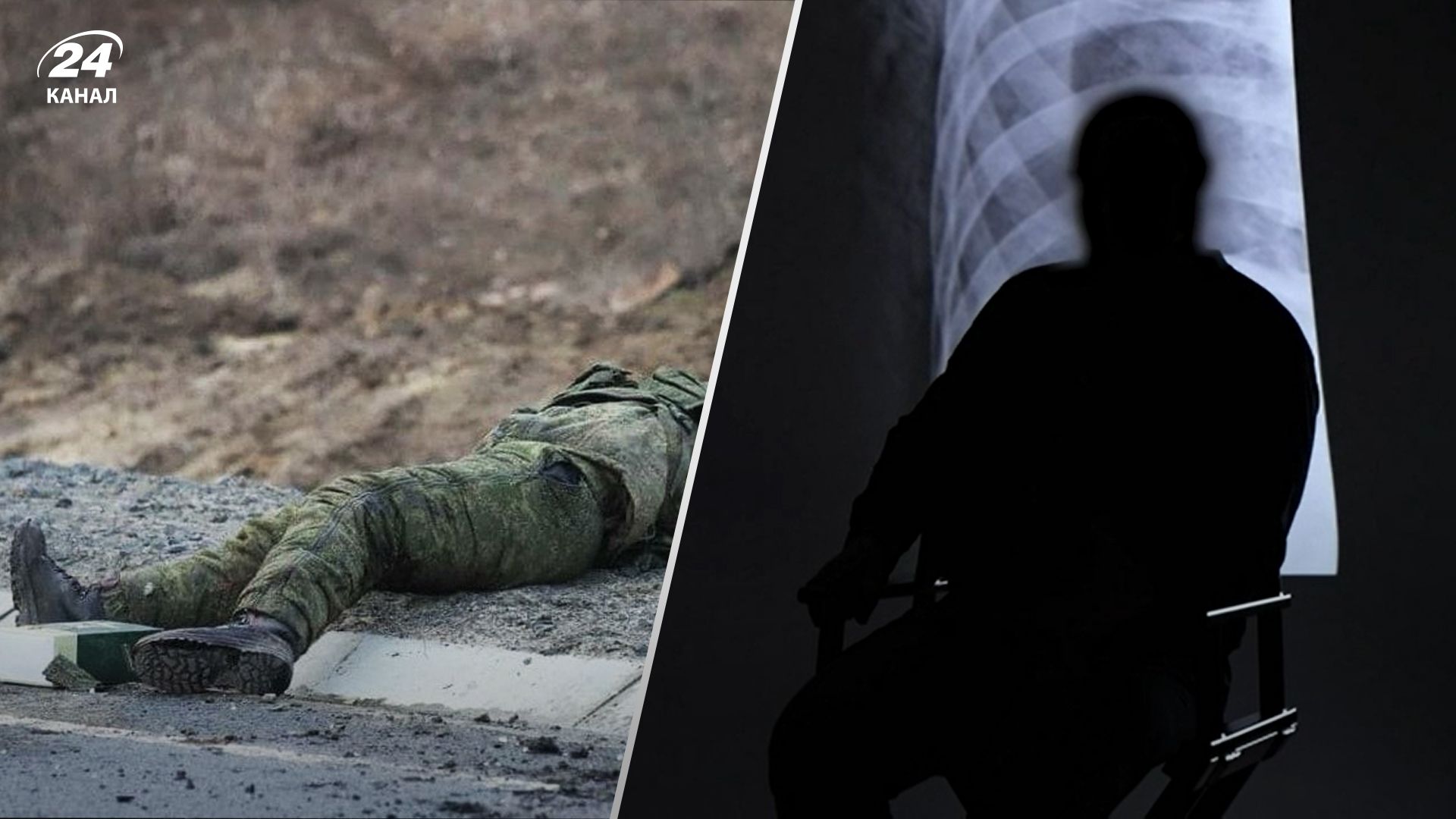 Скалічені солдати прибували в лікарні щодня Скалічені солдати прибували в лікарні щодня