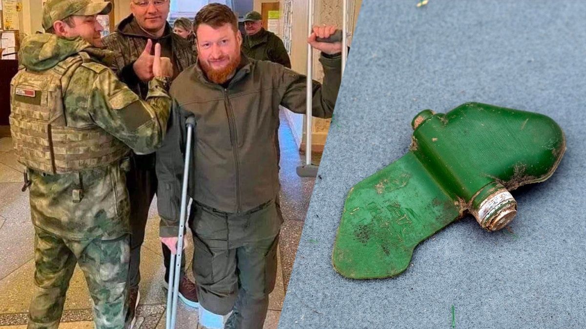 Пропагандисту Пєгову, який став на Лєпесток, ампутували частину ноги - 24 Канал Пропагандисту Пєгову, який став на Лєпесток, ампутували частину ноги - 24 Канал