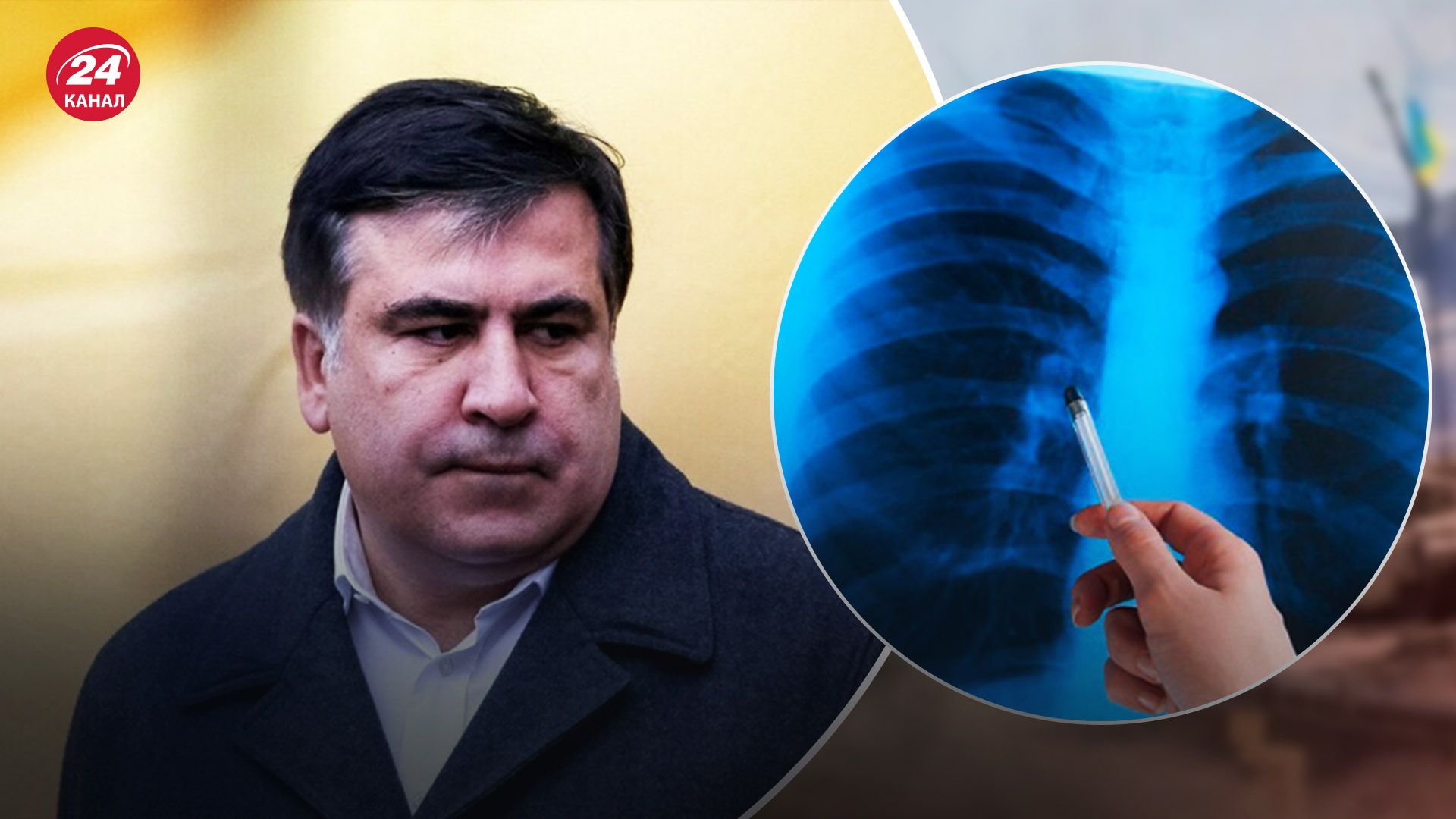 Лікарі перевіряють стан здоров'я грузинського політика Лікарі перевіряють стан здоров'я грузинського політика