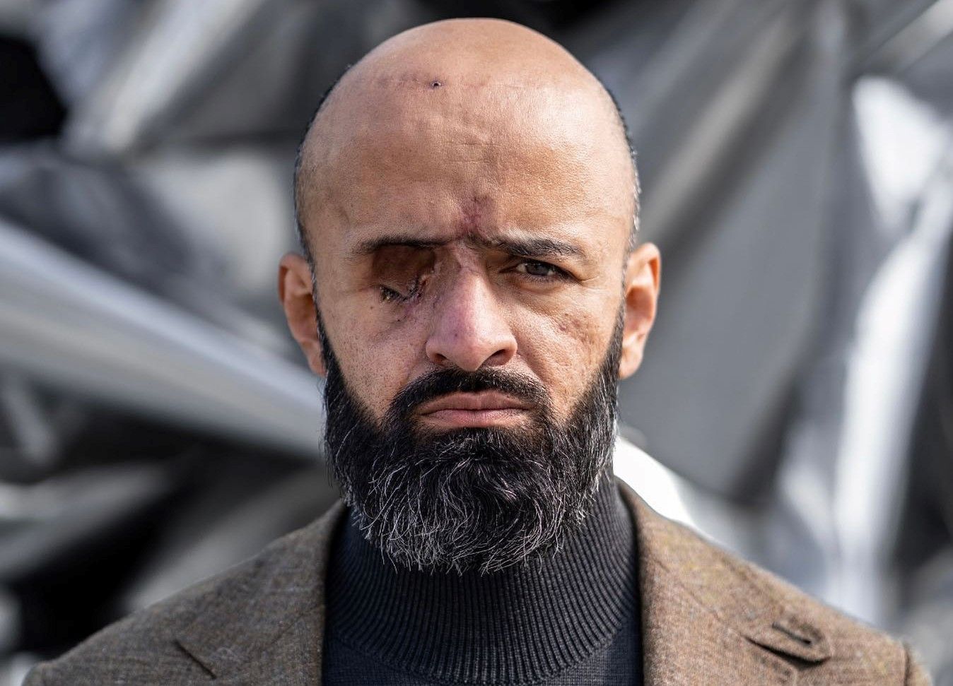 Массе Найема попросили надеть повязку на глаз Массе Найема попросили надеть повязку на глаз