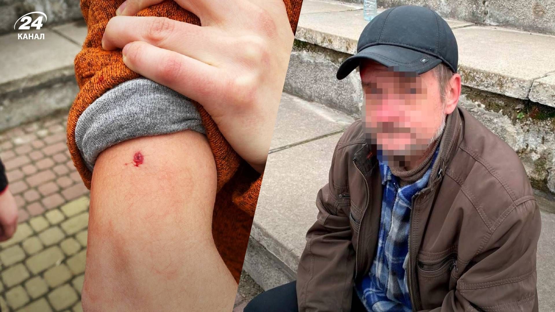 В Киеве мужчина из пневматического пистолета выстрелил в женщину В Киеве мужчина из пневматического пистолета выстрелил в женщину