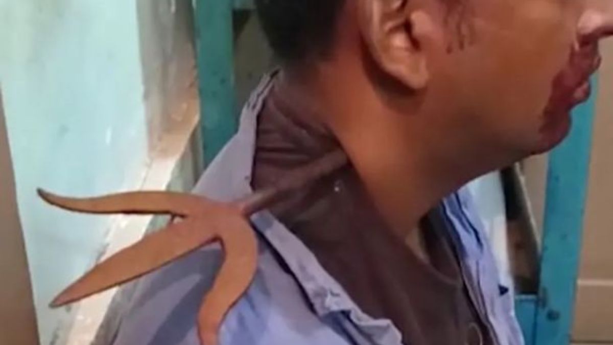 Мужчине пробили шею 150-летним трезубцем Мужчине пробили шею 150-летним трезубцем