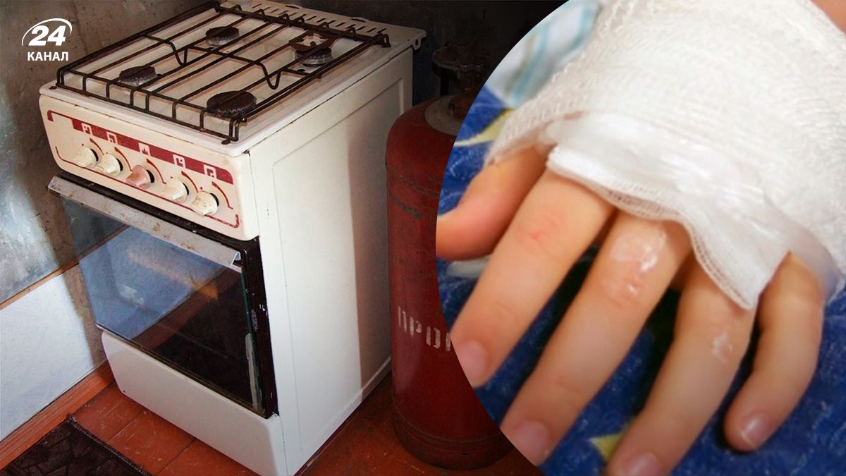 Дитина отримала опіки від вибуху газових балонів - 24 Канал Дитина отримала опіки від вибуху газових балонів - 24 Канал